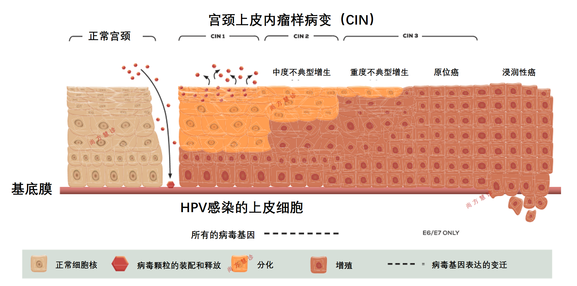 “消除宫颈癌，健康中国在行动”科普巡讲在深圳举行 北大深圳医院专家呼吁及早接种HPV疫苗_筛查