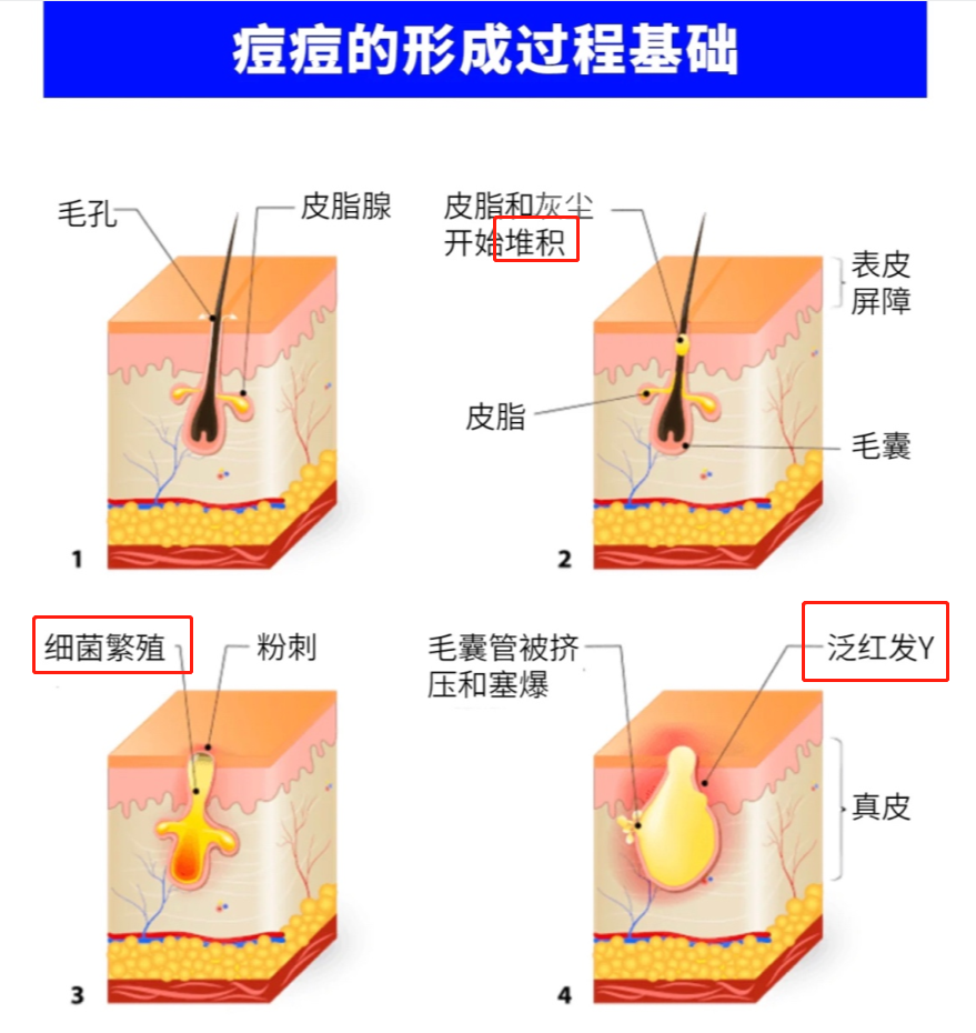 面部祛痘 痘痘 痘印通通拿下73