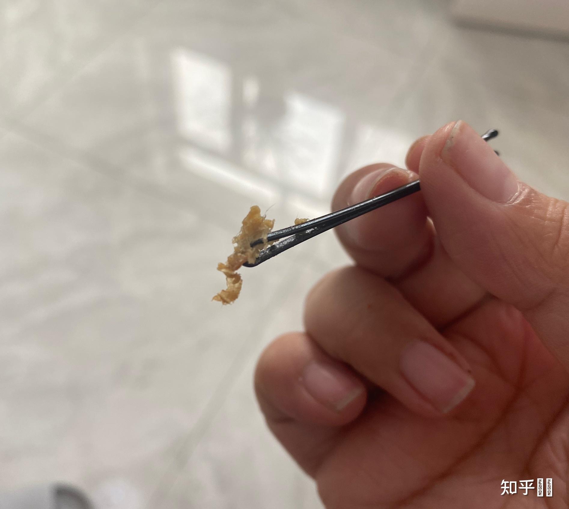 耳屎最大能有多大? - 知乎