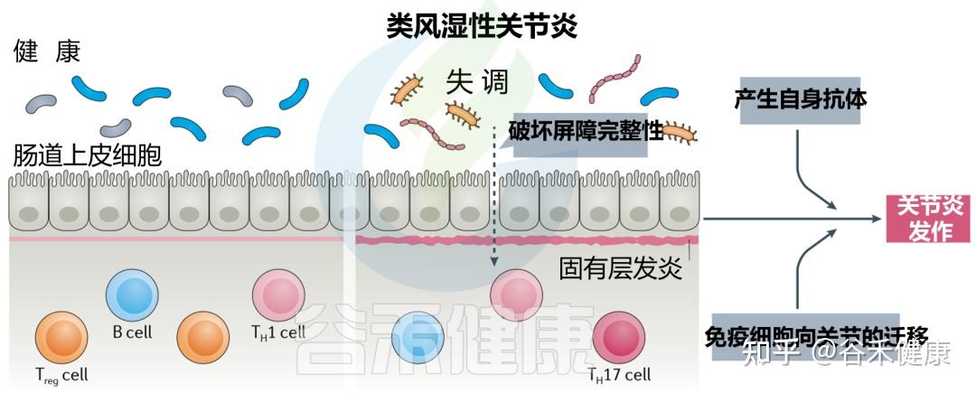 类风湿性关节炎机制图片