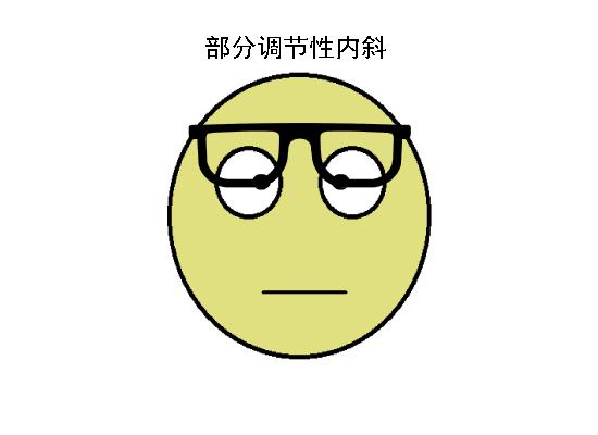 开眼角是否可以改善斜视 v2-a677dd6d364425f113a523756d217259_r.jpg