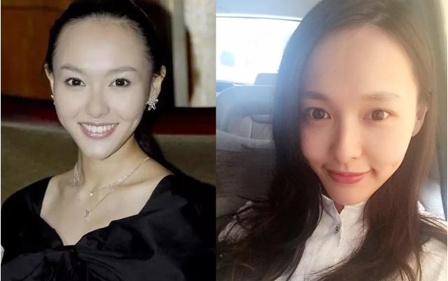 发际线高大脑门怎么办?国字脸该怎么办呢? - 知乎