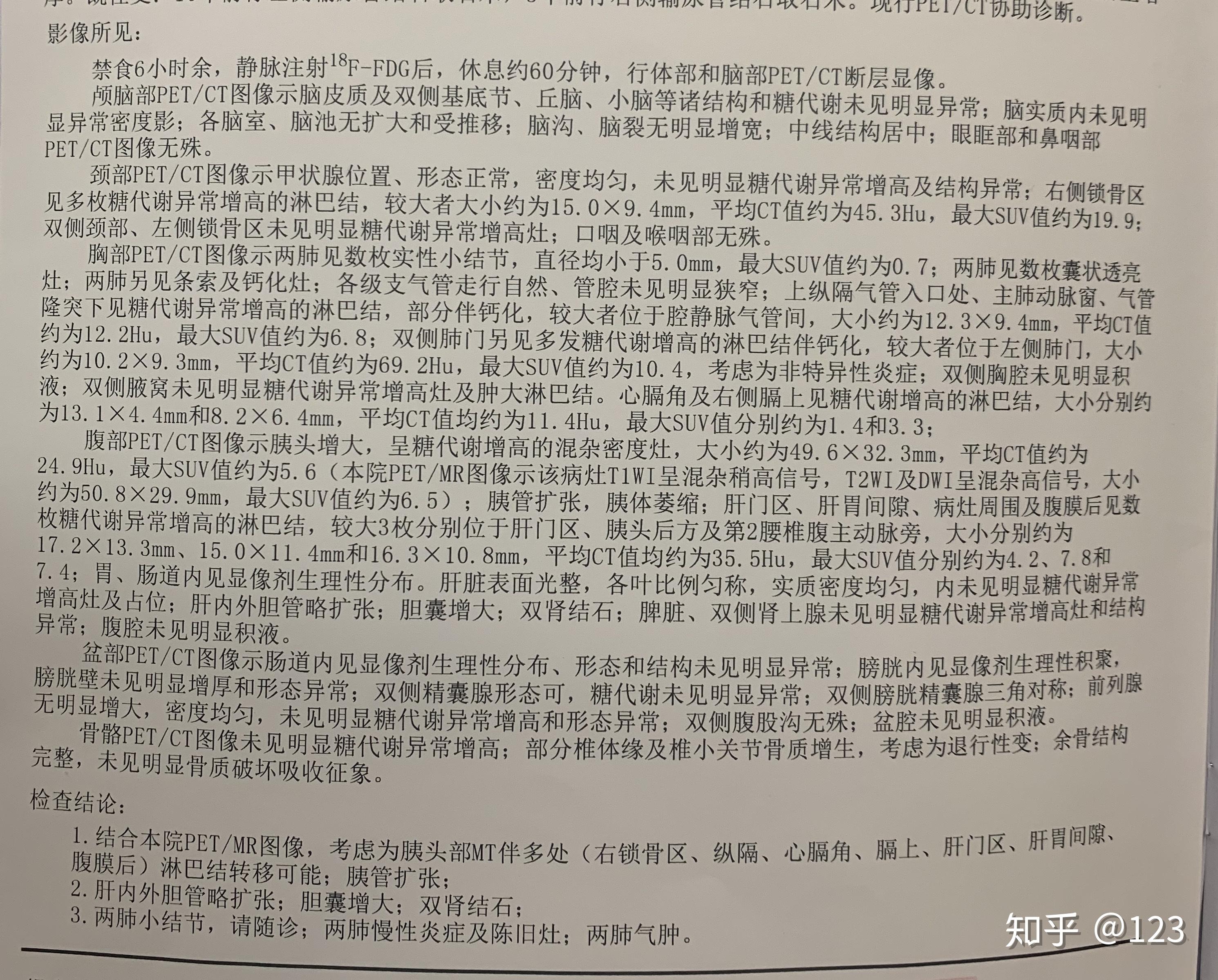 病理不能確定為胰腺癌那到底是惡性還是良性