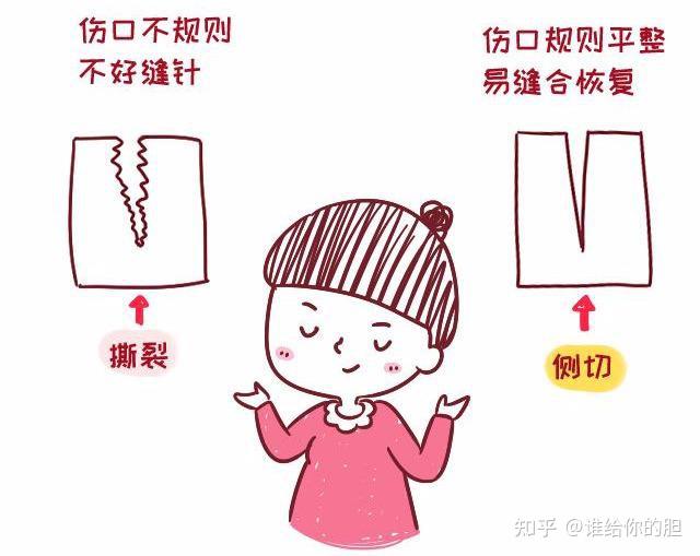 顺产时，自然撕裂、侧切哪个恢复快？有什么区别和影响？ - 知乎