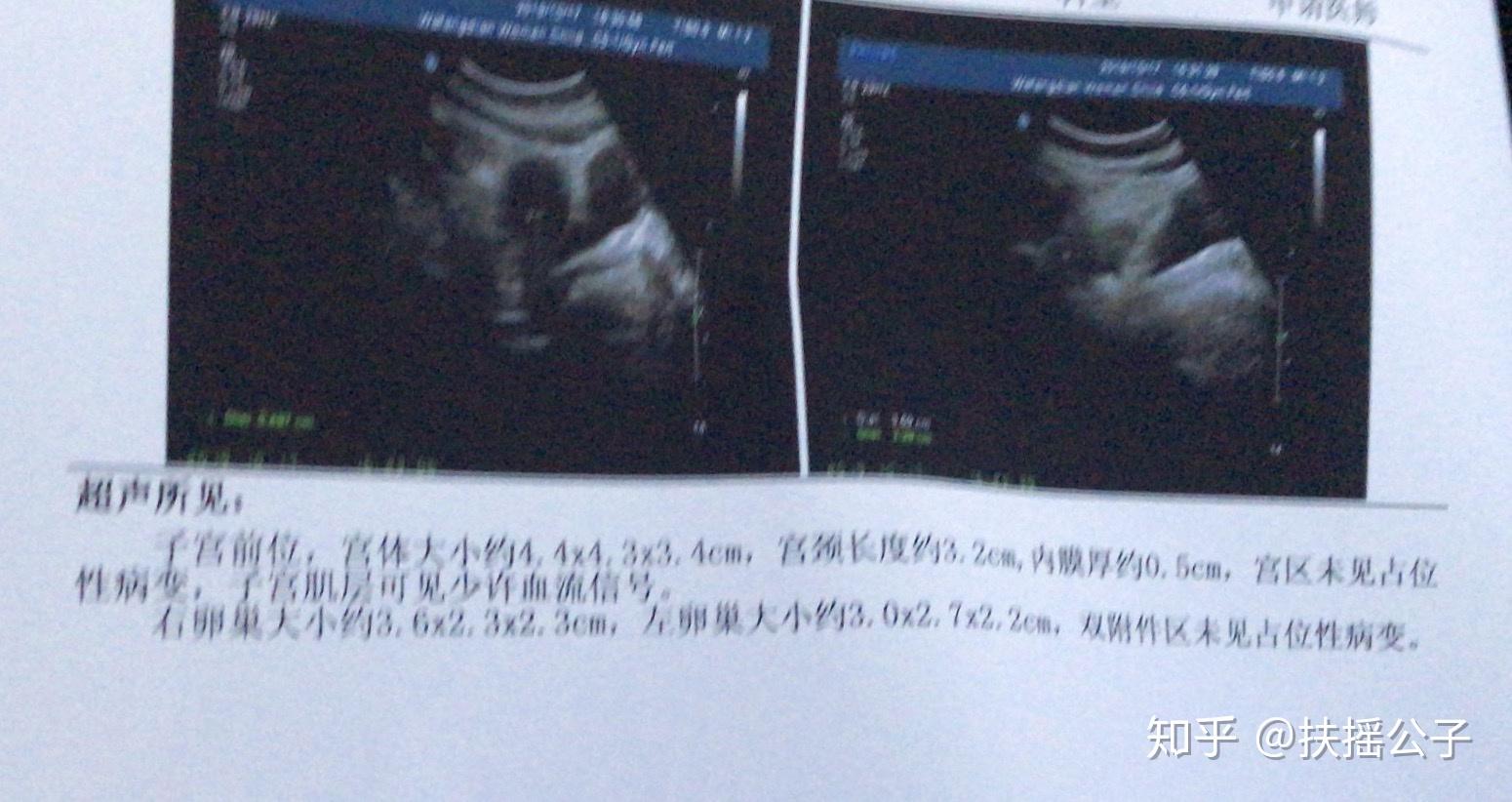 吃什么药可以让月经停了 v2-a70d89fc5c5b02a999291b47ed65be59_r.jpg