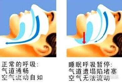 怎么说话不会嗓子疼 v2-a72085714d33f4c568736bc7092eef75_b.jpg