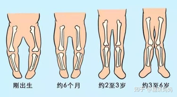 1)与骨骼肌肉的发育有关新生儿的骨骼和肌肉都尚未发育完善,无法支撑