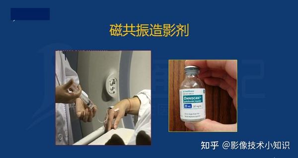 MRI对比剂 - 知乎