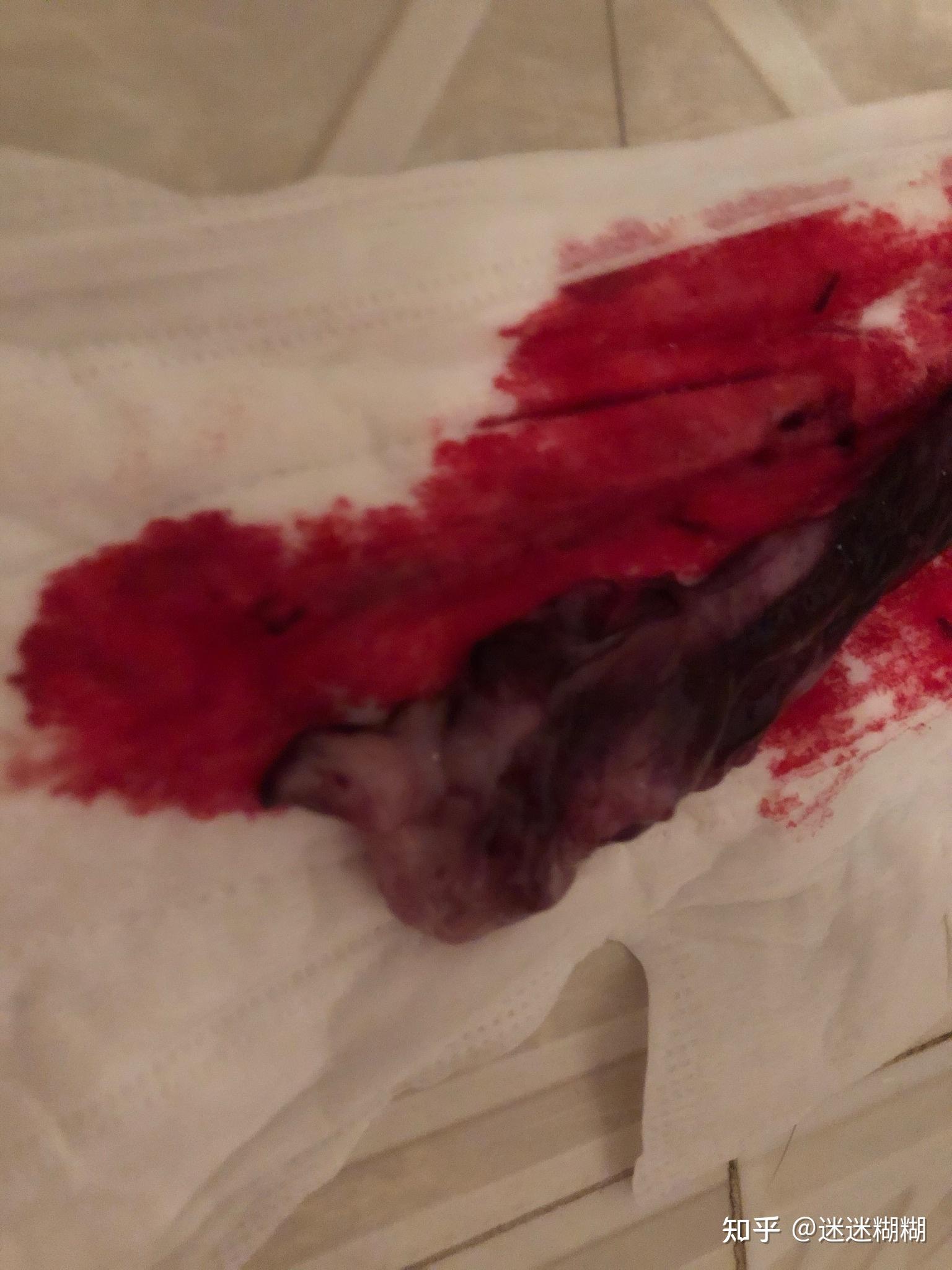 来月经留了一条跟肉一样的东西吓死我了不知道这是什么血块又不像