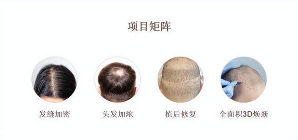 纹发是什么意思？|选择SMP纹发，这几点一定要注意 - 知乎
