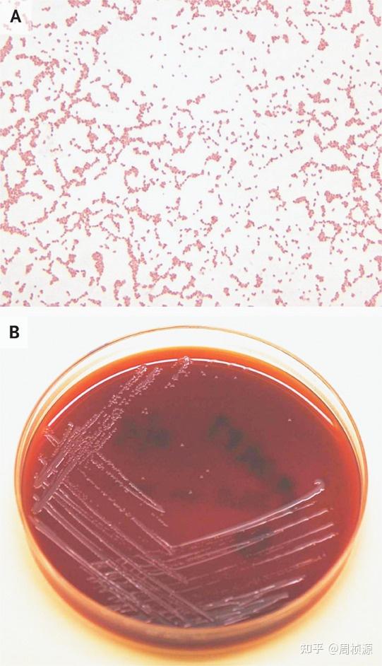 诊断结果来自于3套有氧和厌氧菌血养瓶.住院第1天在急诊采血.