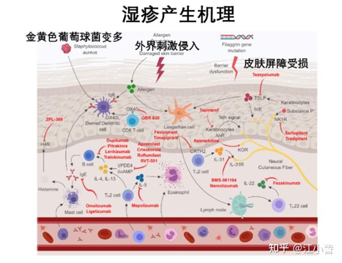 皮肤又干又痒?你有可能是特应性皮炎 - 知乎