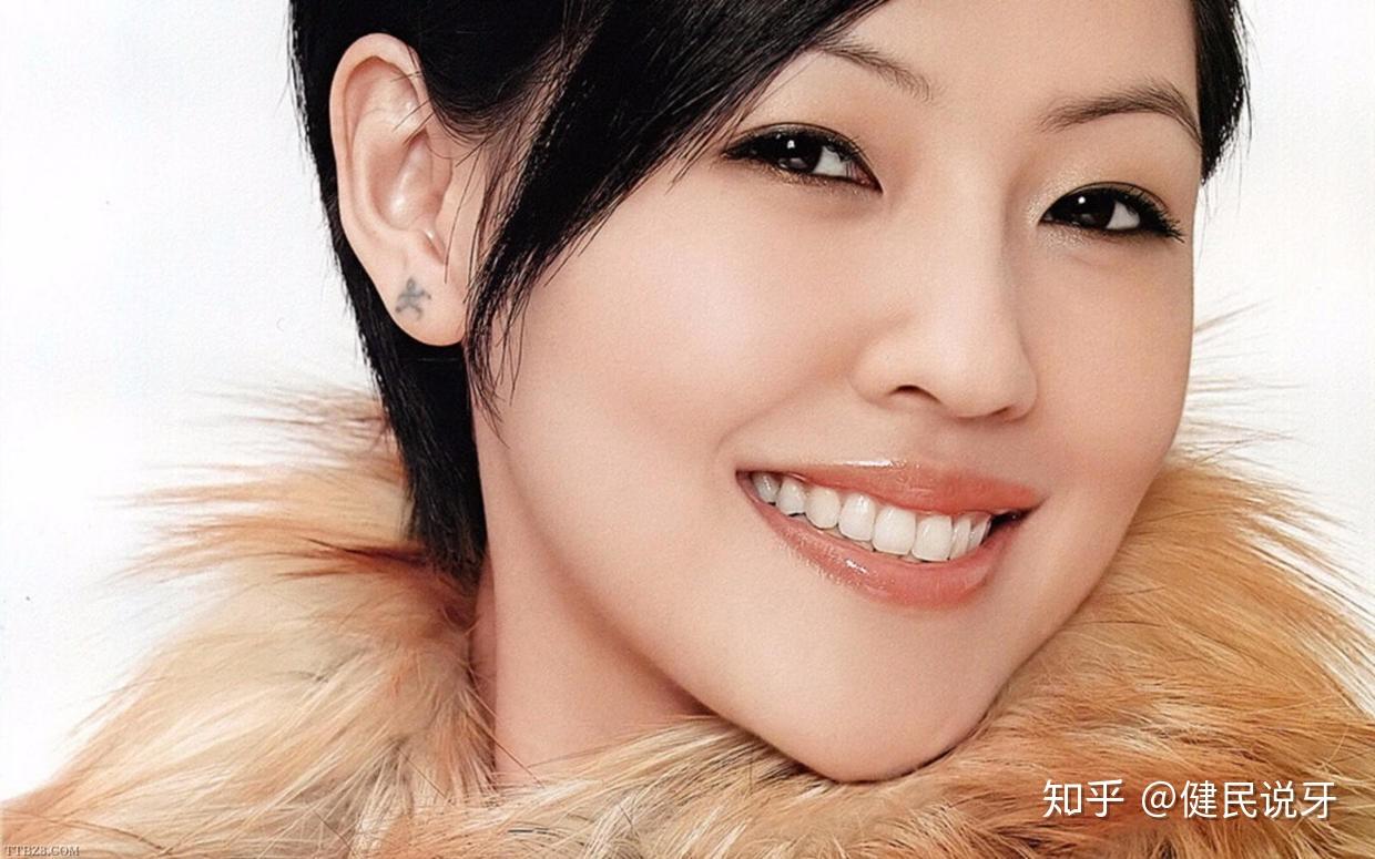 给牙齿矫正的明星,第一位不得不提小s.