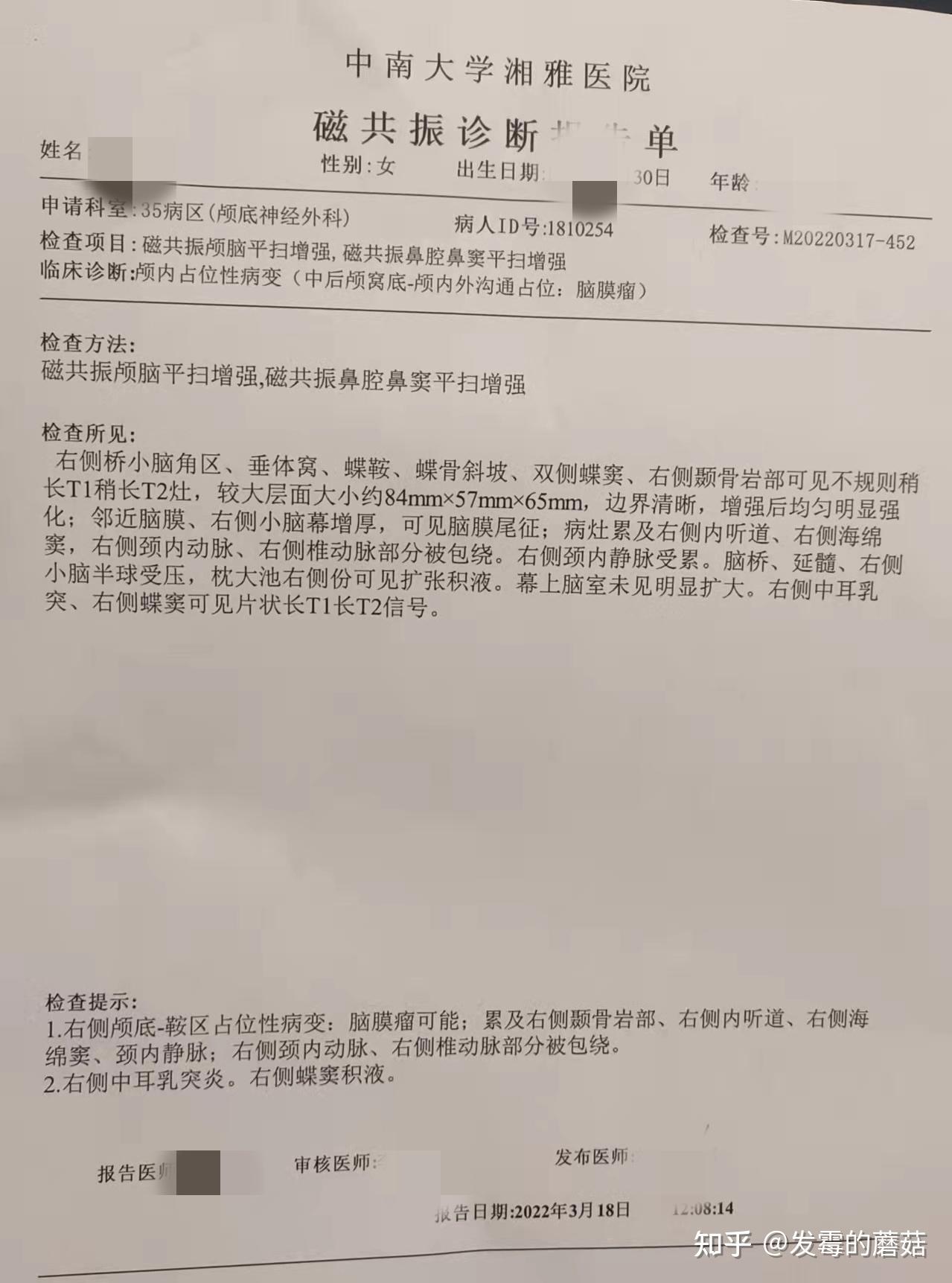 你们认为各个科室最大的手术是什么？