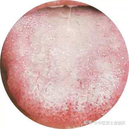 史上最全舌诊图谱!【珍藏版】 - 知乎