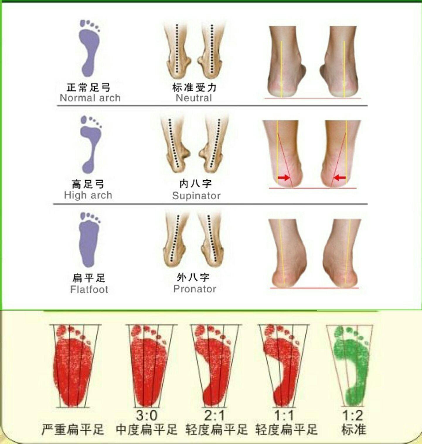 一路上来我发现好多女的都是扁平足,感觉
