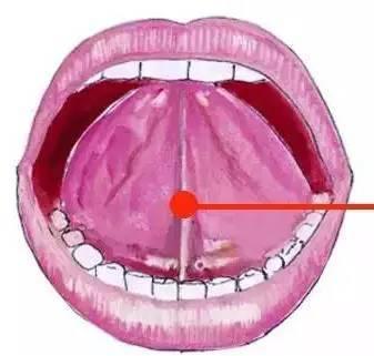 甄益乐舌系带短会影响孩子说话吗