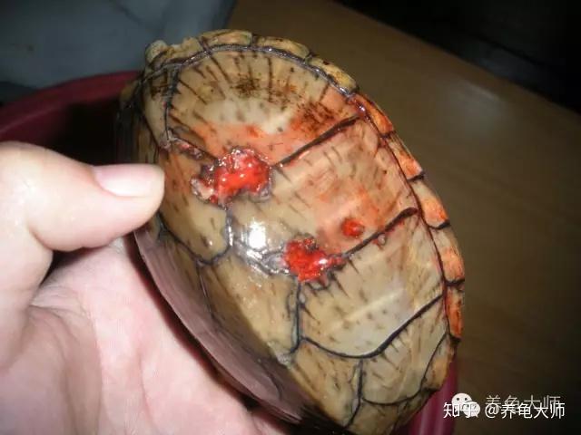 龟腐甲的治疗方式