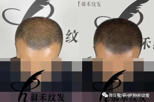 纹发可以模仿头发不同长度 - 知乎