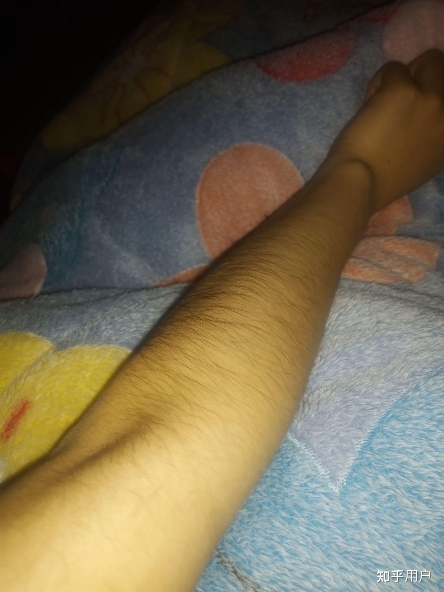 女生长浓密手毛是一种什么样的体验