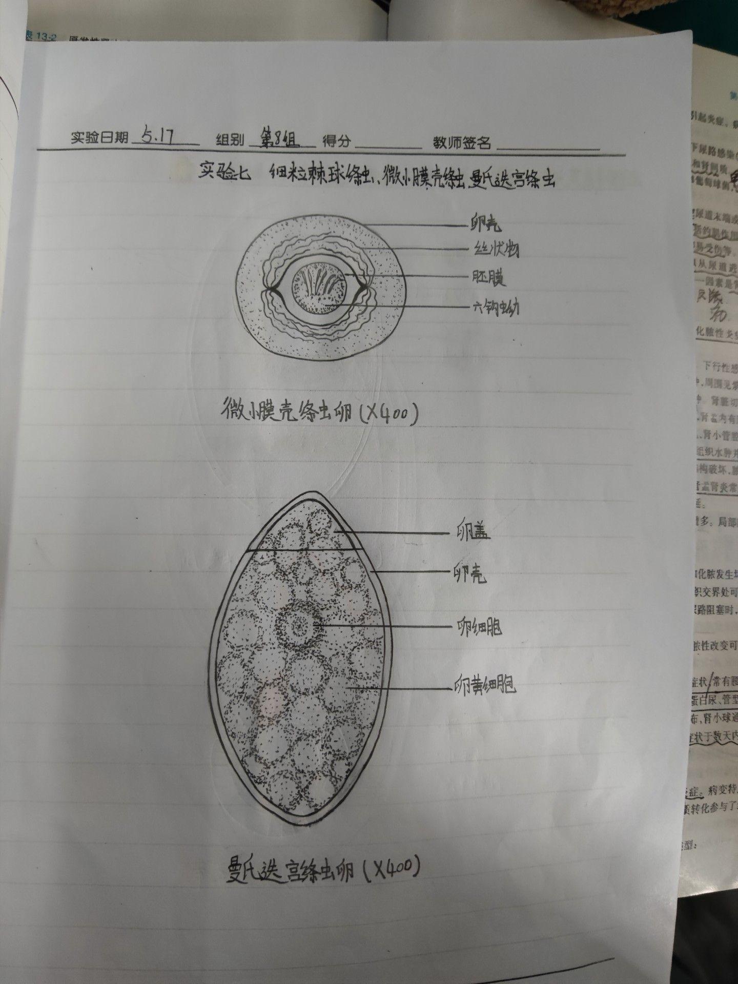 人体寄生虫卵图片