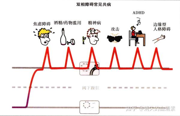 双相障碍症状大全,看这一篇就够了,躁篇 - 知乎