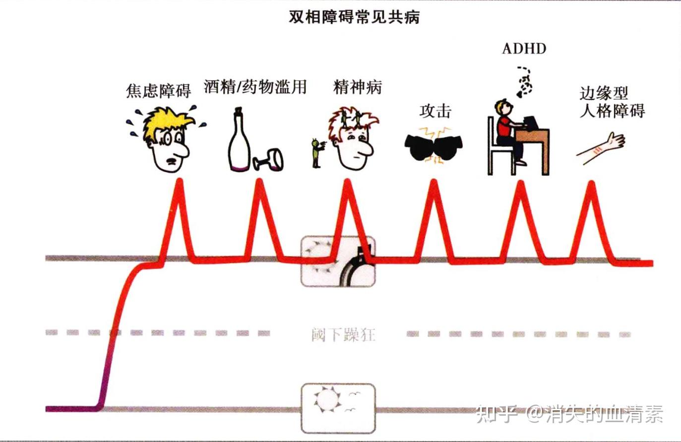 双相障碍症状大全,看这一篇就够了,躁篇 - 知乎