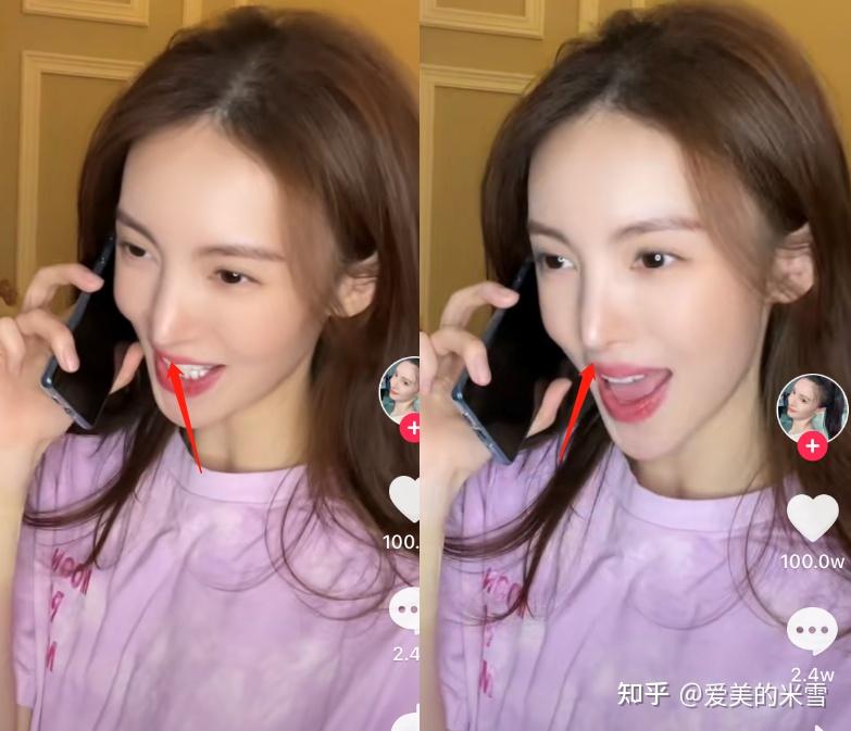 金晨陈小纭娜扎吴宣仪get同款尖鼻子为什么女明星都喜欢把鼻子做成