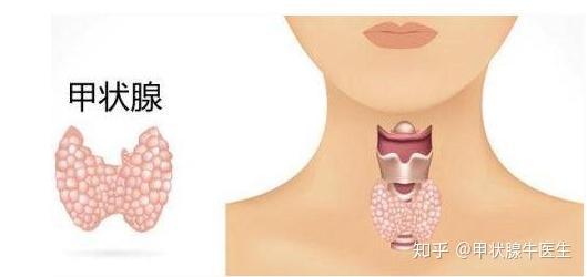 为什么患甲状腺疾病的人越来越多 知乎