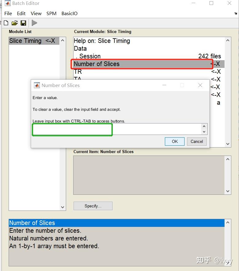 SPM数据预处理 -单被试 - 知乎