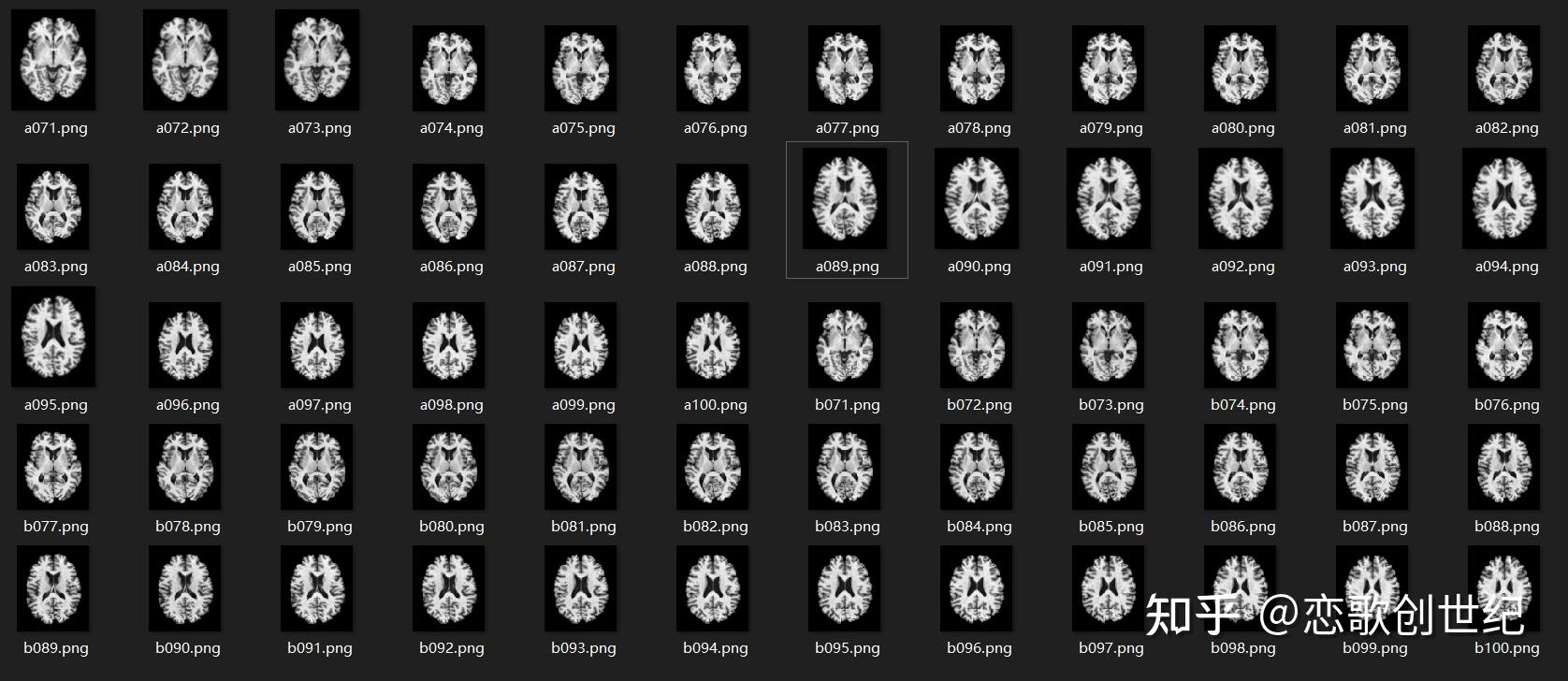 Mri nii 2d 