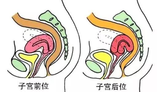 子宫后位排恶露姿势图片