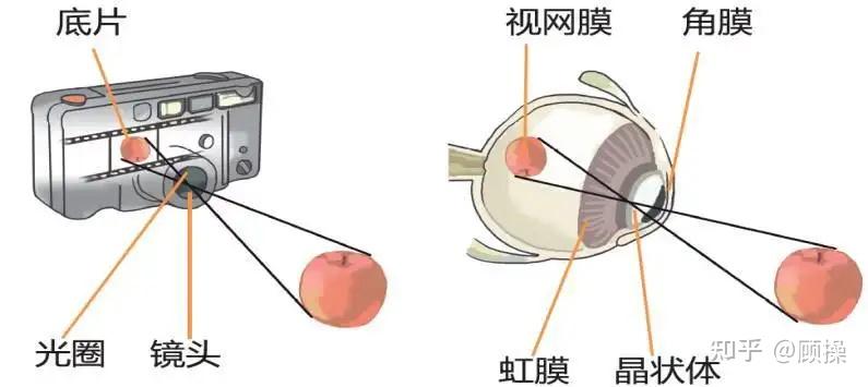 正常情況下,晶狀體由晶狀體懸韌帶懸掛固定在睫狀體上,前後軸與視軸