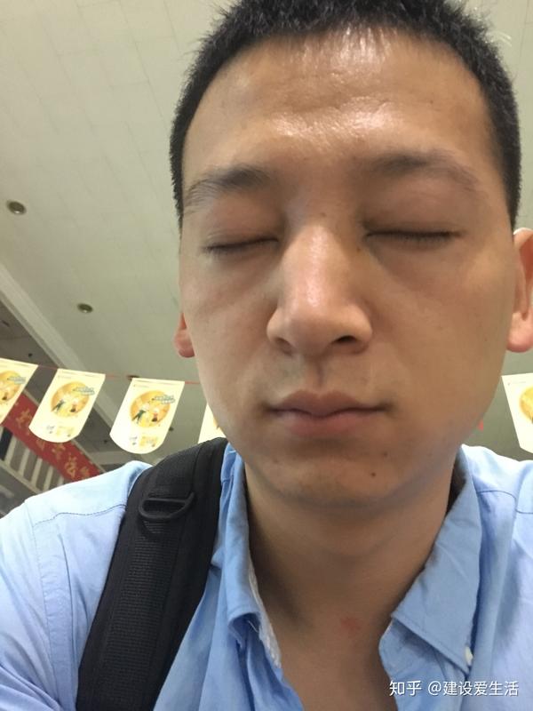 打篮球鼻骨 鼻中隔骨折是什么体验 知乎