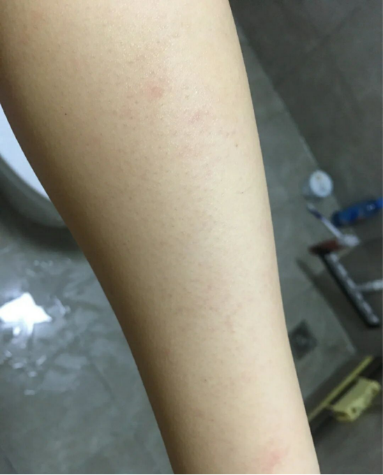 脱毛膏对身体的危害有多大?