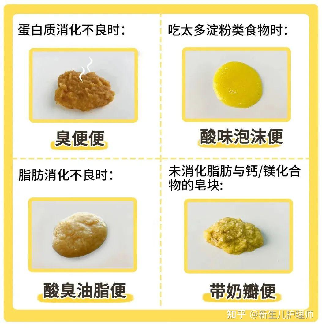 如果宝宝出现这种便便，必须尽快就医！一刻别耽误！ - 知乎