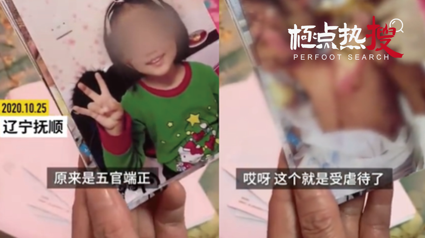 惨不忍睹 辽宁六岁女童遭亲妈虐待敲断牙齿手段极其残忍 知乎