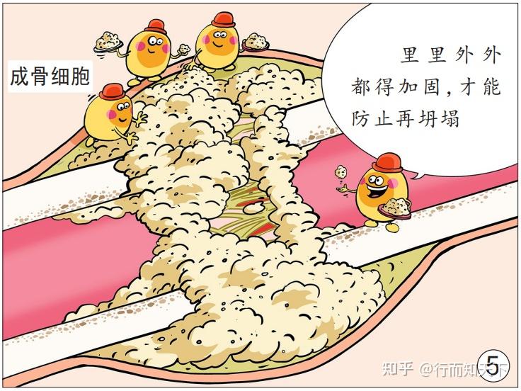 “伤筋动骨”真的100天才能恢复吗? - 知乎