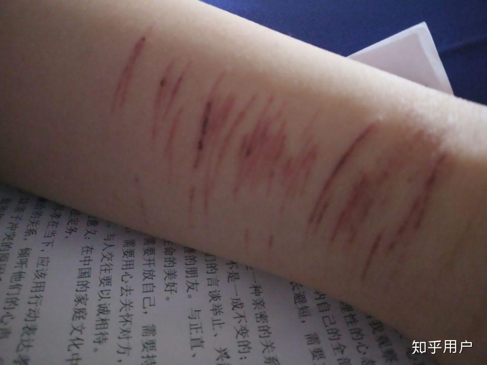 父母知道自己孩子自残会怎么样