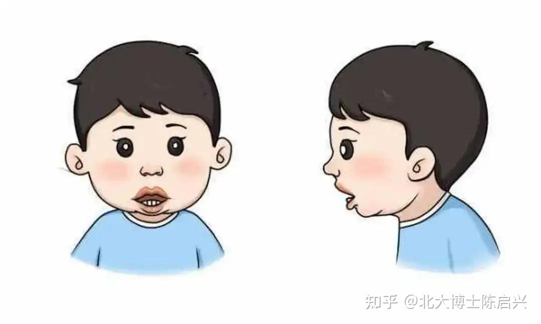 【口呼吸】唇舌肌训练,在家也能做 - 知乎