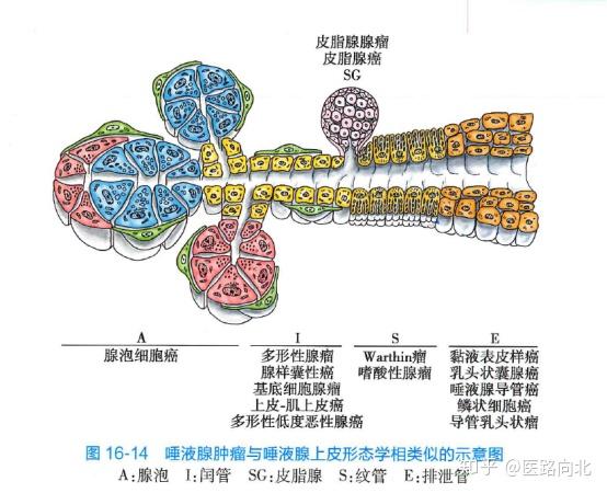 坏死性涎腺化生图片