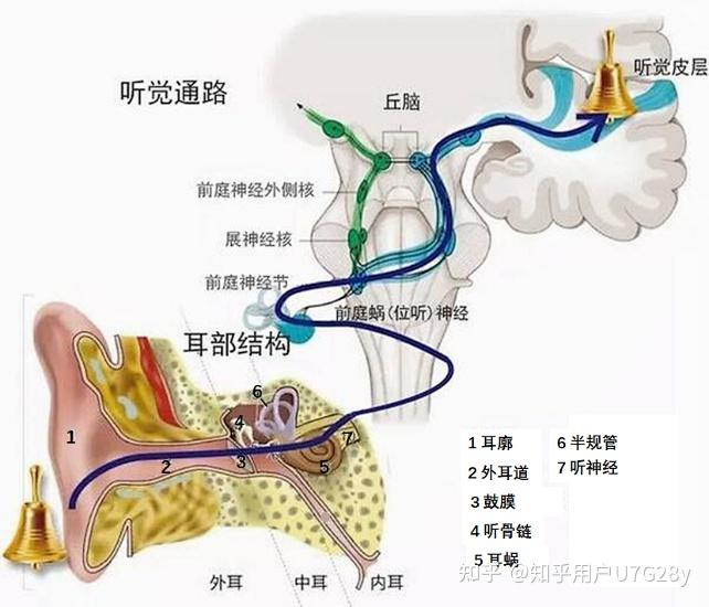 耳道式助听器结构图图片