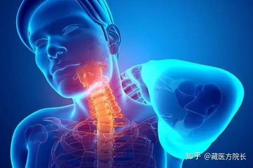 你真了解痉挛性斜颈吗?你知道如何自查吗? - 知乎