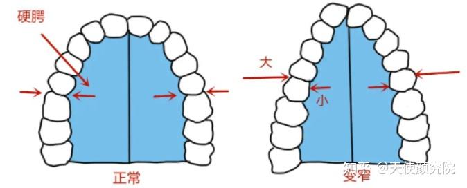 郑秀妍这段太蛊了吧!芒果台怎么能删了不播??!(郑秀妍签约英皇)