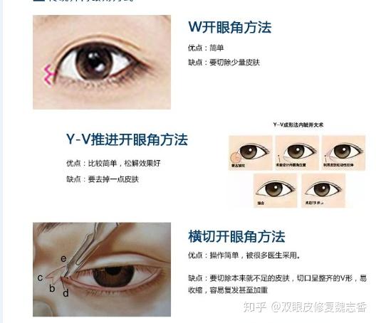 内眼角修复解决的问题是什么疤痕开的过大