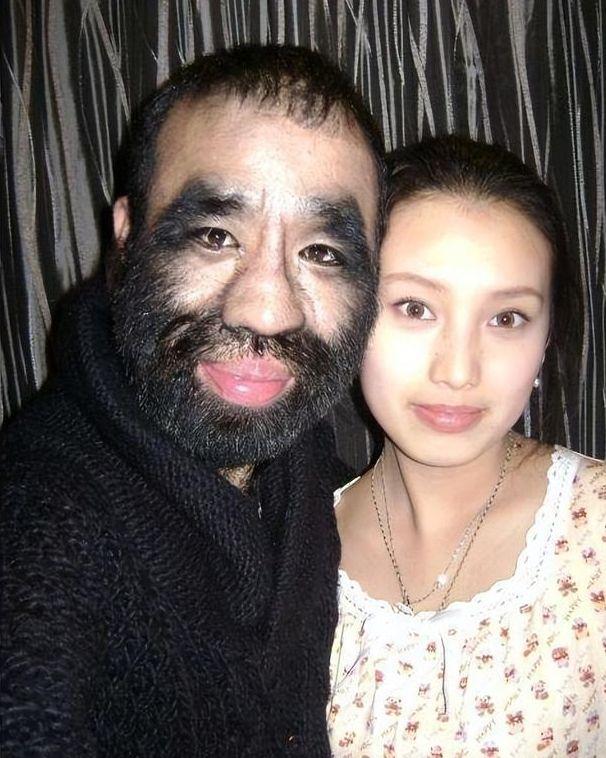 中国第一毛孩于震寰为恋爱被逼脱毛42岁才娶妻生子了