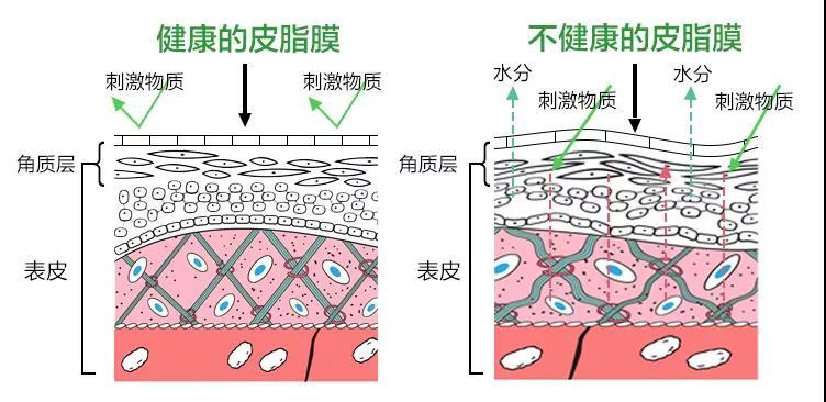 皮肤屏障受损会怎样？ - 知乎