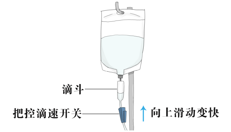 吊针怎么调速快慢图解图片