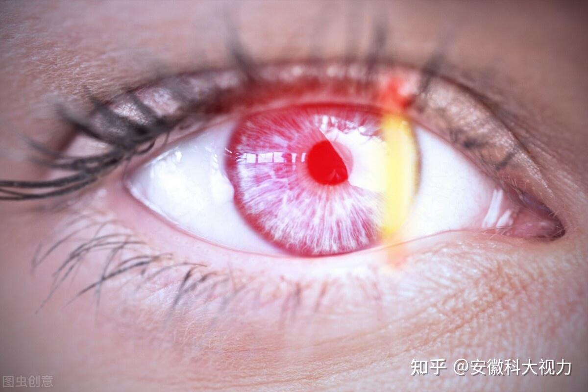 oled屏与lcd屏哪个更伤眼睛电子产品对眼睛的危害