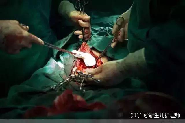 3分钟剖腹产视频曝光哪个女人不是在用命生孩子